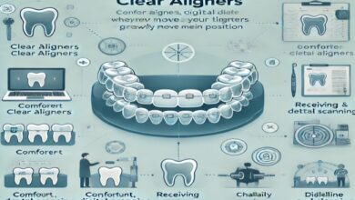 Clear aligners