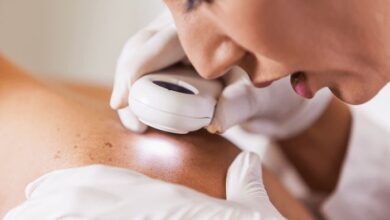 The Critical Benefits Of Professional Skin Check Services