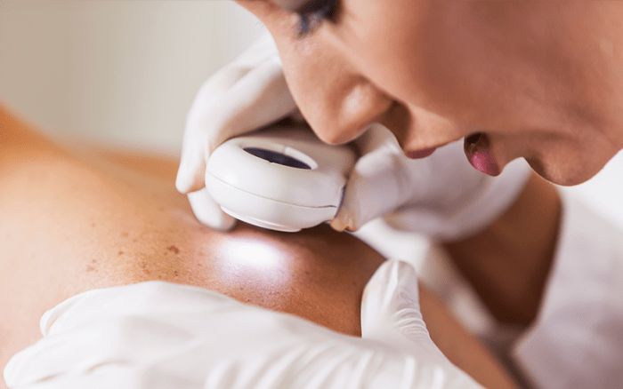 The Critical Benefits Of Professional Skin Check Services