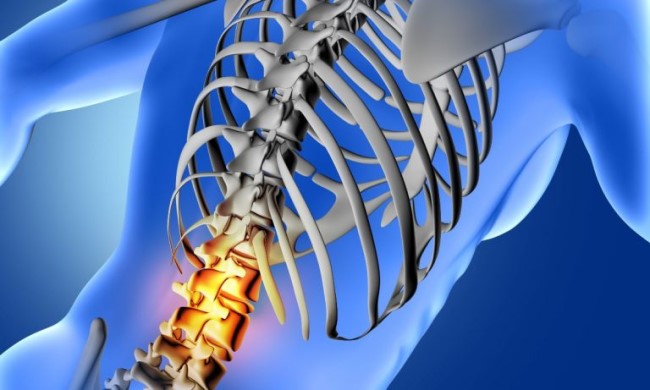 Spinal Cord Injury