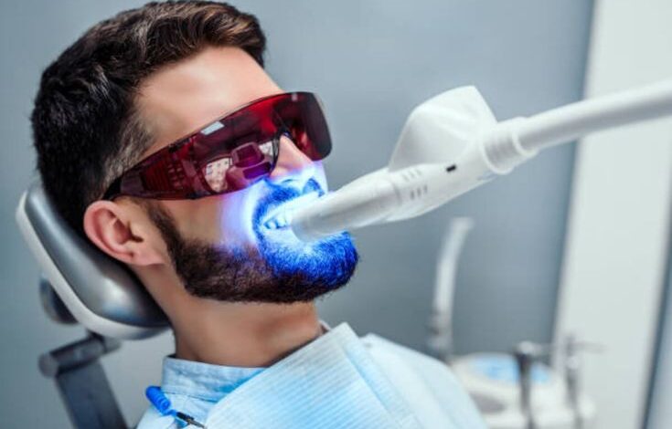 Teeth Whitening Services