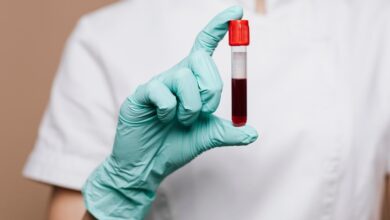 Right Blood Test Lab