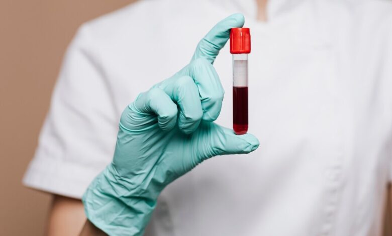 Right Blood Test Lab