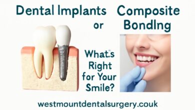 Dental Implants