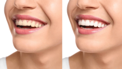 Crest 3D White Strips