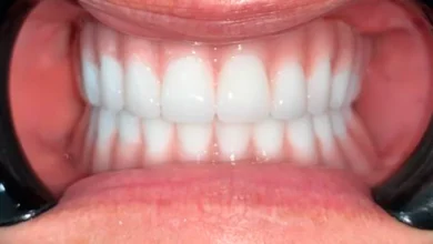 Cancun’s Dental Boom: A Health Story with Economic Bite