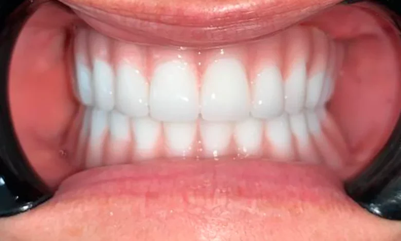 Cancun’s Dental Boom: A Health Story with Economic Bite