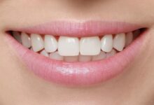 6 Key Factors That Influence Bonding