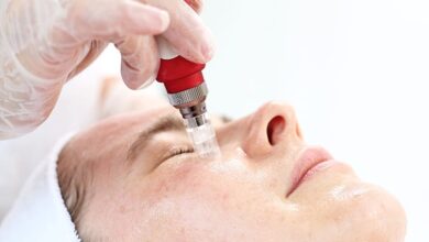Microneedling