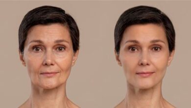 Plane Facelift Surgery